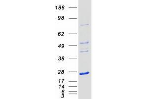 Validation with Western Blot (NKIRAS1 Protein (Myc-DYKDDDDK Tag))