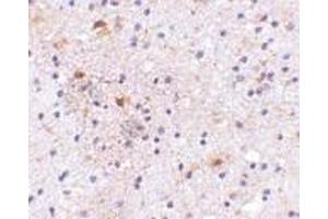 Immunohistochemistry of CAPS1 in human brain with CAPS1 antibody at 5 μg/ml. (CADPS antibody  (C-Term))