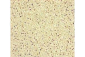 MMACHC antibody  (AA 63-282)