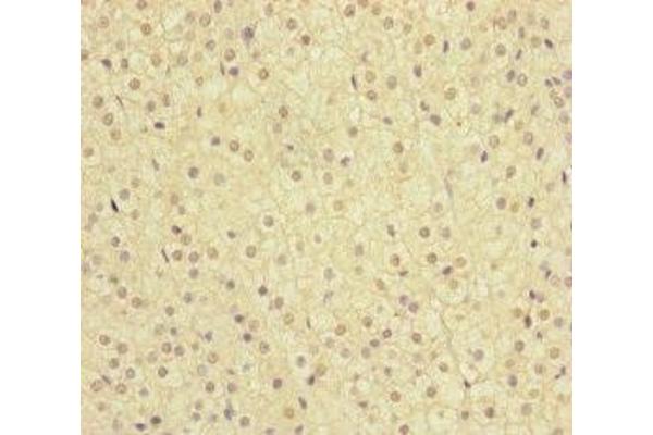 MMACHC antibody  (AA 63-282)