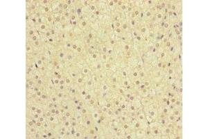 Immunohistochemistry of paraffin-embedded human adrenal gland tissue using ABIN7159655 at dilution of 1:100 (MMACHC antibody  (AA 63-282))