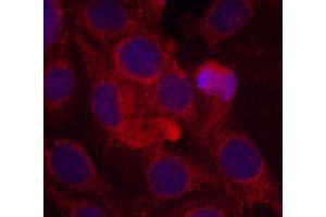 Immunofluorescence staining of methanol-fixed MCF-7 cells using Phospho-KDR-Y1175 antibody (ABIN2988109). (VEGFR2/CD309 antibody  (pTyr1175))