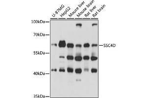 Western blot analysis of extracts of various cell lines, using SSC4D antibody (ABIN7270158) at 1000 dilution. (SRCRB4D antibody  (AA 446-575))