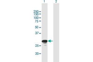 Western Blot analysis of RAB26 expression in transfected 293T cell line by RAB26 MaxPab polyclonal antibody. (RAB26 antibody  (AA 1-256))