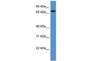 WB Suggested Anti-Angel1 Antibody Titration: 0. (ANGEL1 antibody  (C-Term))