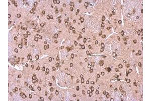 IHC-P Image LYRIC antibody [N2C3] detects LYRIC protein at cytosol on mouse fore brain by immunohistochemical analysis. (MTDH antibody)