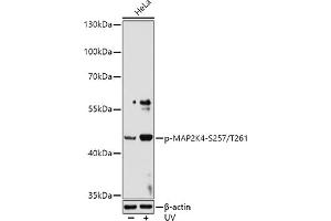 Western blot analysis of extracts of HeLa cells, using Phospho-MK4-S257/T261 antibody (ABIN6135256, ABIN6136136, ABIN6136137 and ABIN6225569) at 1:1000 dilution. (MAP2K4 antibody  (pSer257, pThr261))