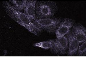 Immunofluorescence staining of HeLa cells (Human cervical epitheloid carcinoma, ATCC CCL-2. (UBE2L3 antibody  (AA 15-133))