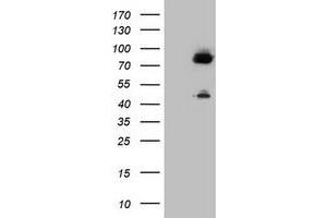 Image no. 1 for anti-Coagulation Factor XIII, A1 Polypeptide (F13A1) antibody (ABIN1498154) (F13A1 antibody)