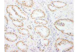 anti-General Transcription Factor IIIC, Polypeptide 5 (GTF3C5) (AA 469-519) antibody