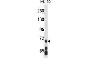 Western Blotting (WB) image for anti-Myeloid/lymphoid Or Mixed-Lineage Leukemia 5 (Trithorax Homolog) (MLL5) antibody (ABIN2995217) (MLL5/KMT2E antibody)