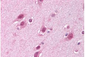 Human Brain, Cortex (formalin-fixed, paraffin-embedded) stained with HUWE1 antibody ABIN213933 at 5 ug/ml followed by biotinylated goat anti-rabbit IgG secondary antibody ABIN481713, alkaline phosphatase-streptavidin and chromogen. (HUWE1 antibody  (C-Term))