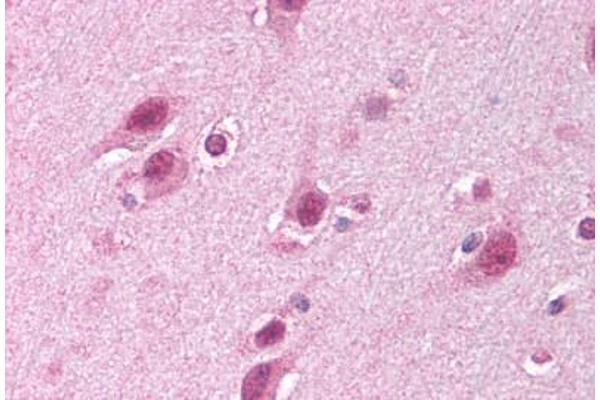 HUWE1 antibody  (C-Term)