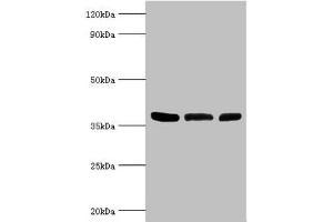 Western blot All lanes: ARG2 antibody at 5 μg/mL Lane 1: Mouse liver tissue Lane 2: 293T whole cell lysate Lane 3: Mouse kidney tissue Secondary Goat polyclonal to rabbit IgG at 1/10000 dilution Predicted band size: 39 kDa Observed band size: 39 kDa