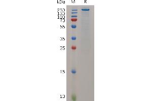 Teneurin Transmembrane Protein 4 (TENM4) (AA 367-2771) protein (His tag)