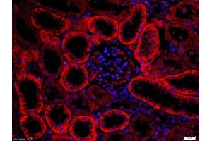 Paraformaldehyde-fixed, paraffin embedded rat kidney, Antigen retrieval by boiling in sodium citrate buffer (pH6) for 15min, Block endogenous peroxidase by 3% hydrogen peroxide for 30 minutes, Blocking buffer (normal goat serum) at 37°C for 20min, Antibody incubation with Rabbit Anti-FZD3/Frizzled 3 Polyclonal Antibody, Unconjugated  at 1:200 overnight at 4°C, followed by the secondary antibody was Goat Anti-Rabbit IgG, Cy3 conjugated-Cy3)used at 1:200 dilution for 40 minutes at 37°C. (FZD3 antibody  (AA 121-220))