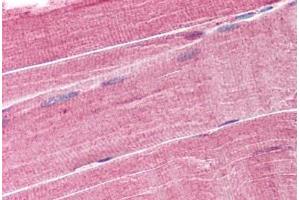 Human Skeletal Muscle (formalin-fixed, paraffin-embedded) stained with TRIM63 antibody ABIN293523 at 1. (TRIM63 antibody  (AA 2-14))