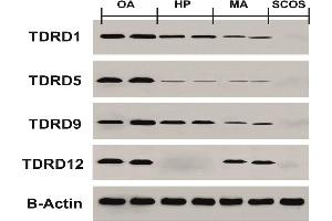 Western blotting test results for protein expression of TDRDs genes in HP, MA, SCOS, and OA samples compared to control group Source: PMID32059713