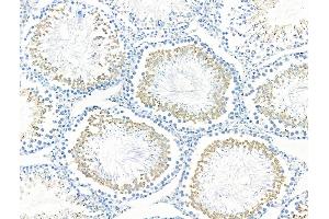 anti-Cysteinyl Leukotriene Receptor 1 (CYSLTR1) (Internal Region) antibody