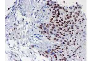 Image no. 8 for anti-WW Domain Containing Transcription Regulator 1 (WWTR1) antibody (ABIN1501763) (WWTR1 antibody)