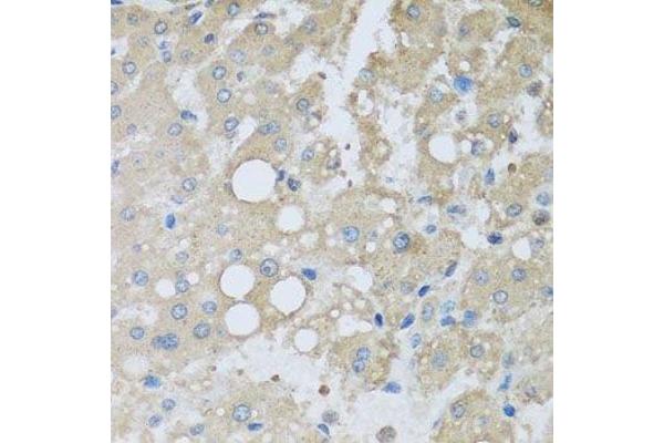CHMP1B antibody  (AA 1-199)