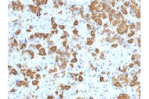 Formalin-fixed, paraffin-embedded human Pituitary stained with Growth Hormone Monoclonal Antibody (GH/1371). (Growth Hormone 1 antibody  (AA 58-187))