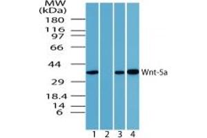 Image no. 1 for anti-Wingless-Type MMTV Integration Site Family, Member 5A (WNT5A) (AA 190-230) antibody (ABIN207746) (WNT5A antibody  (AA 190-230))