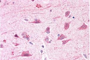 ABIN2613396 (5µg/ml) staining of paraffin embedded Human Cortex. (BOD1L1 antibody  (AA 2802-2815))