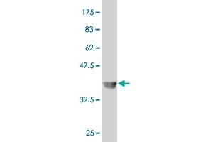 Western Blot detection against Immunogen (37 KDa) . (SLC18A2 antibody  (AA 53-151))