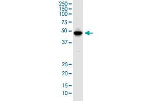 IKIP monoclonal antibody (M02), clone 2D5. (IKbIP antibody  (AA 1-377))