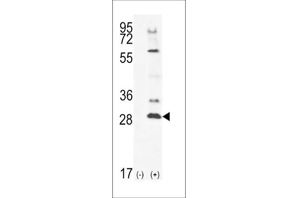TSSK4 antibody  (C-Term)