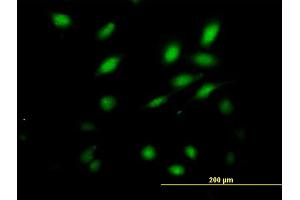 Immunofluorescence of purified MaxPab antibody to NFAM1 on HeLa cell. (NFAM1 antibody  (AA 1-270))