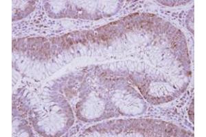 Image no. 1 for anti-Glucose-Fructose Oxidoreductase Domain Containing 2 (GFOD2) (AA 198-385) antibody (ABIN1498450) (GFOD2 antibody  (AA 198-385))