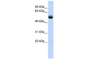 Western Blotting (WB) image for anti-Translocation Associated Membrane Protein 1-Like 1 (TRAM1L1) antibody (ABIN2459605) (TRAM1L1 antibody)