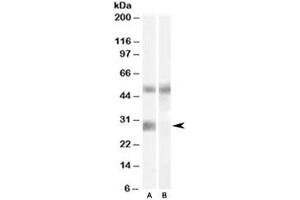 Western blot testing of human breast cancer lysate with IGFBP3 antibody at 0. (IGFBP3 antibody)