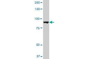 ALDH1L1 polyclonal antibody (A01), Lot # PUM4060503QCS1. (ALDH1L1 antibody  (AA 803-902))