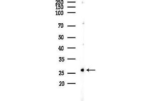 anti-Zinc Finger Protein 575 (ZNF575) (N-Term) antibody