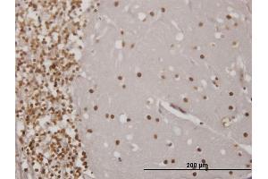 Immunoperoxidase of monoclonal antibody to EN1 on formalin-fixed paraffin-embedded human cerebellum.