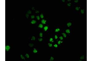 Immunofluorescence staining of Hela cells with ABIN7149505 at 1:200, counter-stained with DAPI. (APPL2 antibody  (AA 399-512))