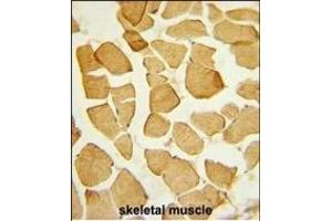 Formalin-fixed and paraffin-embedded human skeletal muscle reacted with EYA4 Antibody (C-term), which was peroxidase-conjugated to the secondary antibody, followed by DAB staining. (EYA4 antibody  (C-Term))