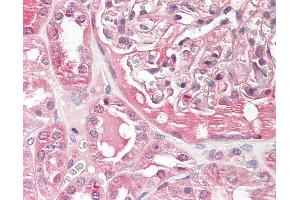 Human Kidney: Formalin-Fixed, Paraffin-Embedded (FFPE). (BCAM antibody  (AA 459-508))