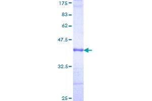 Complement Factor I Protein (CFI) (AA 19-118) (GST tag)