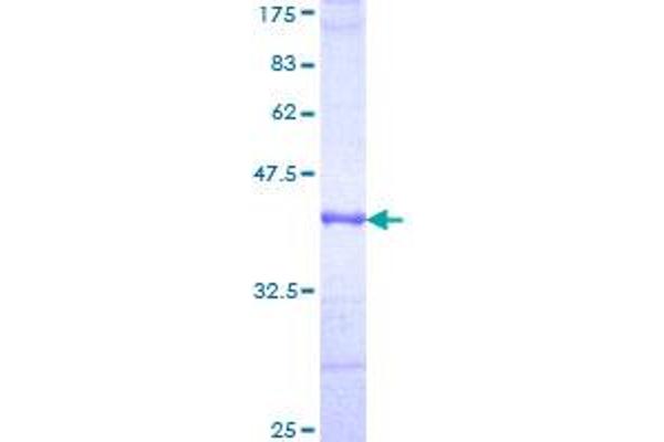 Complement Factor I Protein (CFI) (AA 19-118) (GST tag)