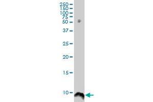 ATOX1 monoclonal antibody (M05), clone 3E1. (ATOX1 antibody  (AA 1-68))