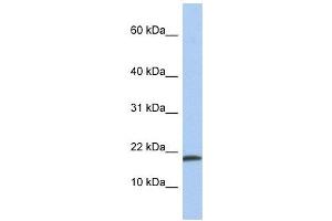 IL1 alpha antibody used at 1 ug/ml to detect target protein. (IL1A antibody  (N-Term))