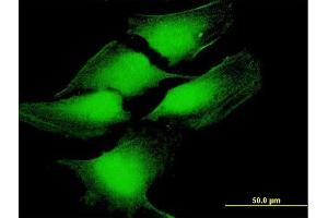 Immunofluorescence (IF) image for anti-Tumor Protein P53 (TP53) (AA 1-393) antibody (ABIN521041)