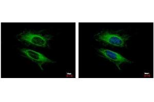 ICC/IF Image VPS11 antibody detects VPS11 protein at cytoplasm by immunofluorescent analysis. (VPS11 antibody  (Center))