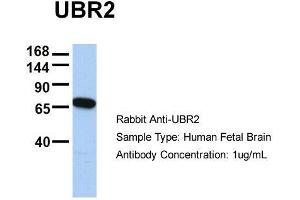 Host:  Rabbit  Target Name:  UBR2  Sample Type:  Human Fetal Brain  Antibody Dilution:  1.