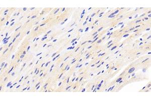 Detection of FNDC5 in Human Cardiac Muscle Tissue using Polyclonal Antibody to Fibronectin Type III Domain Containing Protein 5 (FNDC5) (FNDC5 antibody  (AA 77-144))