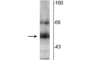 Western blot of hippocampal lysate showing specific immunolabeling of the ~55 kDa TR-β protein. (THRB antibody  (N-Term))